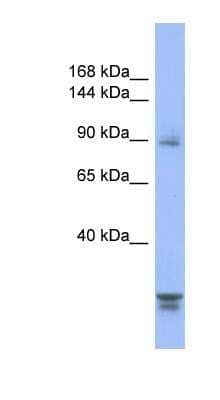 Western Blot: PPP2R3A Antibody [NBP1-54581]