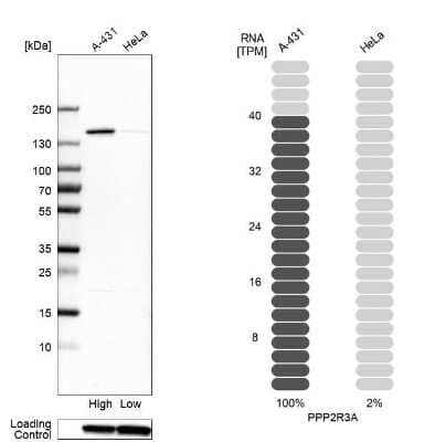 Western Blot: PPP2R3A Antibody [NBP1-87233]