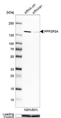 Western Blot: PPP2R3A Antibody [NBP1-87233]