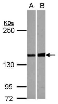 Western Blot: PPP2R3A Antibody [NBP2-19908]