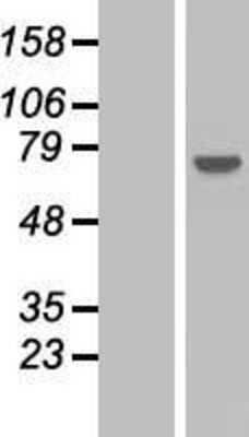 Western Blot: PPP2R3A Overexpression Lysate [NBP2-04878]