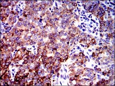 Immunohistochemistry: PPP2R4 Antibody (4D9) - BSA Free [NBP2-37530]