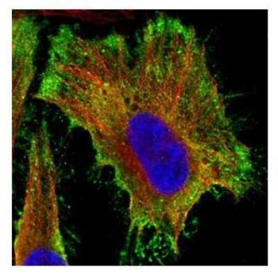 Immunocytochemistry/ Immunofluorescence: PP2A alpha Antibody [NBP1-31266]