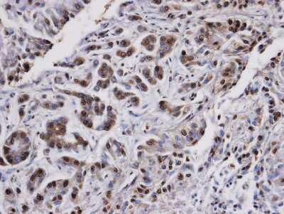 Immunohistochemistry-Paraffin: PP2A alpha Antibody [NBP1-31266]