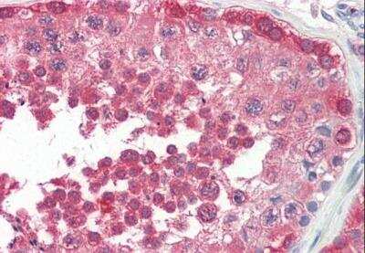 Immunohistochemistry-Paraffin: PPP2R4 Antibody [NBP1-51951]