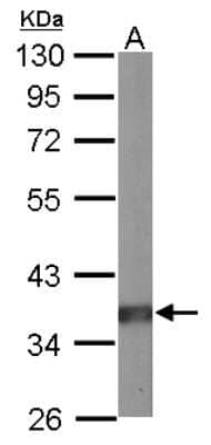 Western Blot: PP2A alpha Antibody [NBP1-31266]