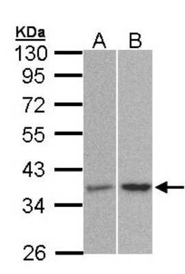 Western Blot: PP2A alpha Antibody [NBP1-31266]