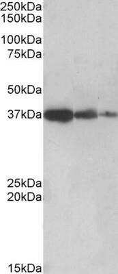 Western Blot: PPP2R4 Antibody [NBP1-51951]