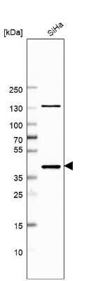 Western Blot: PPP2R4 Antibody [NBP1-87232]