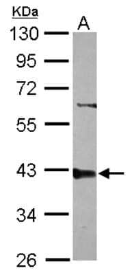 Western Blot: PPP2R4 Antibody [NBP2-19909]