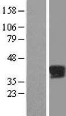 Western Blot: PPP2R4 Overexpression Lysate [NBP2-09896]