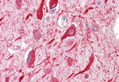 Immunohistochemistry-Paraffin: PPP2R5A Antibody [NB100-847]