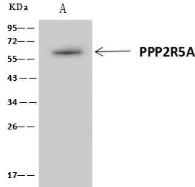 Immunoprecipitation: PPP2R5A Antibody [NBP3-12698]