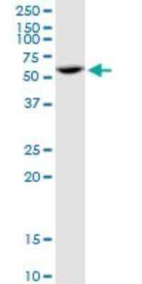 Western Blot: PPP2R5A Antibody [H00005525-B01P]