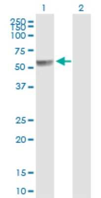 Western Blot: PPP2R5A Antibody [H00005525-B01P]