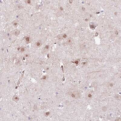 Immunohistochemistry-Paraffin: PPP2R5B Antibody [NBP1-88958]