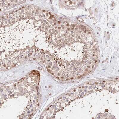 Immunohistochemistry-Paraffin: PPP2R5B Antibody [NBP1-88958]