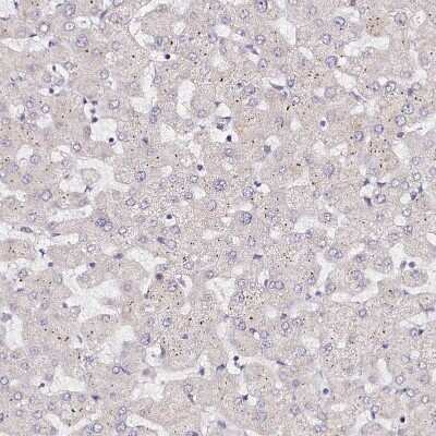 Immunohistochemistry-Paraffin: PPP2R5B Antibody [NBP1-88958]