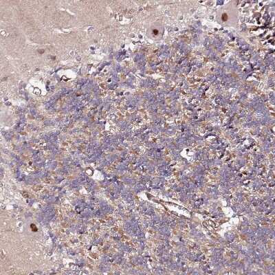 Immunohistochemistry-Paraffin: PPP2R5B Antibody [NBP1-88958]