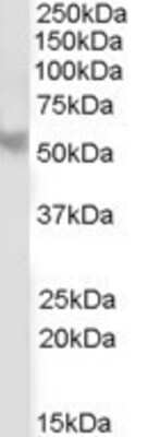 Western Blot: PPP2R5B Antibody [NB100-850]