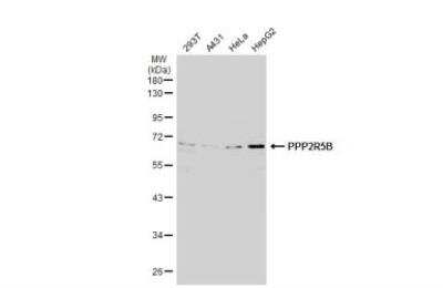 Western Blot: PPP2R5B Antibody [NBP1-31043]