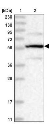 Western Blot: PPP2R5B Antibody [NBP1-88958]