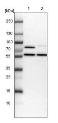 Western Blot: PPP2R5B Antibody [NBP1-88958]