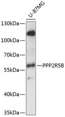 Western Blot: PPP2R5B AntibodyAzide and BSA Free [NBP2-93189]