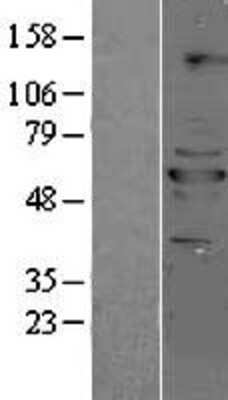 Western Blot: PPP2R5B Overexpression Lysate [NBL1-14701]