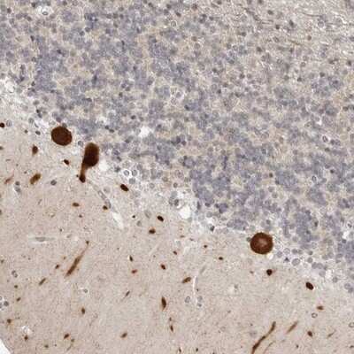 Immunohistochemistry-Paraffin: PPP2R5C Antibody [NBP1-88961]