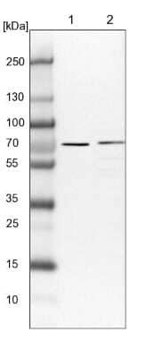 Western Blot: PPP2R5C Antibody [NBP1-88961]