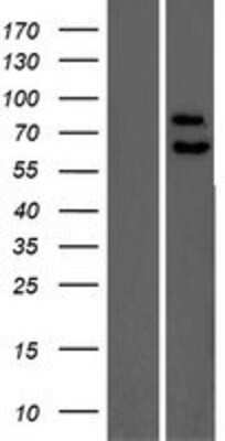 Western Blot: PPP2R5C Overexpression Lysate [NBP2-08076]