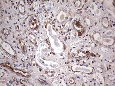 Immunohistochemistry: PPP2R5D Antibody (OTI5E7) [NBP2-45387]