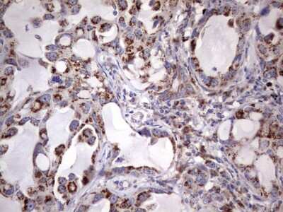 Immunohistochemistry: PPP2R5D Antibody (OTI5E7) [NBP2-45387]