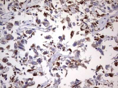 Immunohistochemistry: PPP2R5D Antibody (OTI5E7) [NBP2-45387]