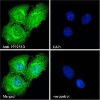 Immunocytochemistry/ Immunofluorescence: PPP2R5D Antibody [NB100-846]