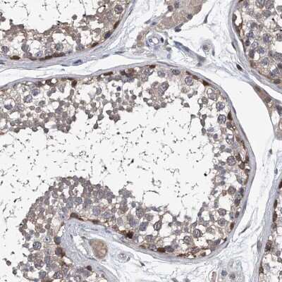 Immunohistochemistry-Paraffin: PPP2R5D Antibody [NBP1-88959]
