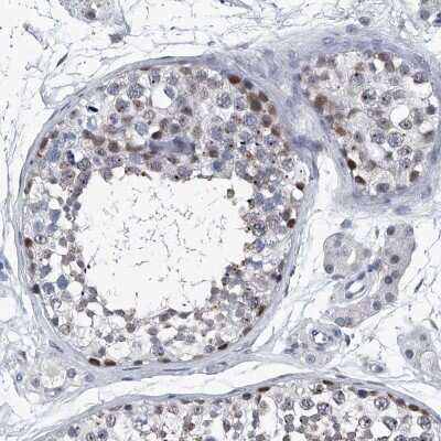 Immunohistochemistry-Paraffin: PPP2R5D Antibody [NBP1-88960]