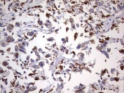 Immunohistochemistry: PPP2R5D Antibody (OTI5E7) - Azide and BSA Free [NBP2-73587]