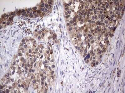 Immunohistochemistry: PPP2R5D Antibody (OTI5E7) - Azide and BSA Free [NBP2-73587]