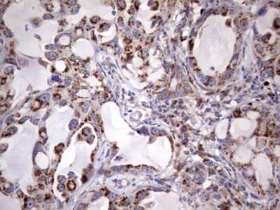 Immunohistochemistry: PPP2R5D Antibody (OTI5E7) - Azide and BSA Free [NBP2-73587]