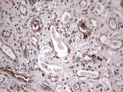 Immunohistochemistry: PPP2R5D Antibody (OTI5E7) - Azide and BSA Free [NBP2-73587]