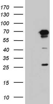 Western Blot: PPP2R5D Antibody (OTI5E7)Azide and BSA Free [NBP2-73587]