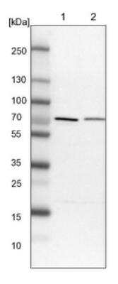 Western Blot: PPP2R5D Antibody [NBP1-88959]
