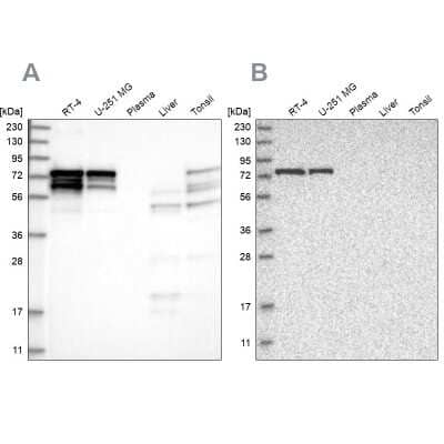 Western Blot: PPP2R5D Antibody [NBP1-88959]