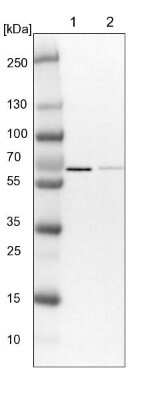 Western Blot: PPP2R5D Antibody [NBP1-88960]
