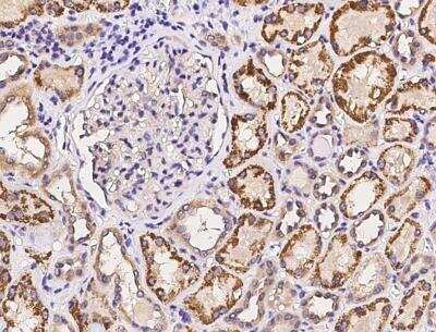Immunohistochemistry-Paraffin: PPP2R5E Antibody [NBP3-06478]