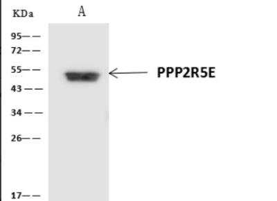 Immunoprecipitation: PPP2R5E Antibody [NBP3-06478]