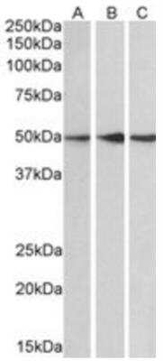 Western Blot: PPP2R5E Antibody [NB100-845]