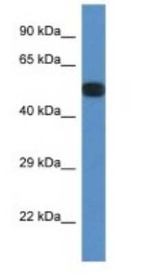 Western Blot: PPP2R5E Antibody [NBP1-74173]